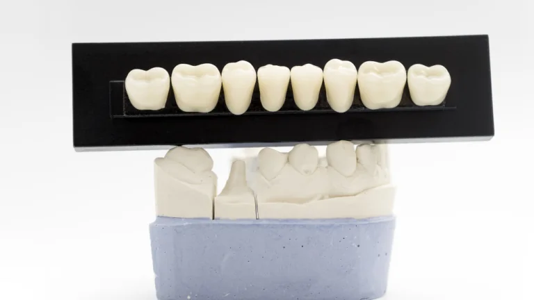 Is Sensitivity After a Crown or Veneer Normal?