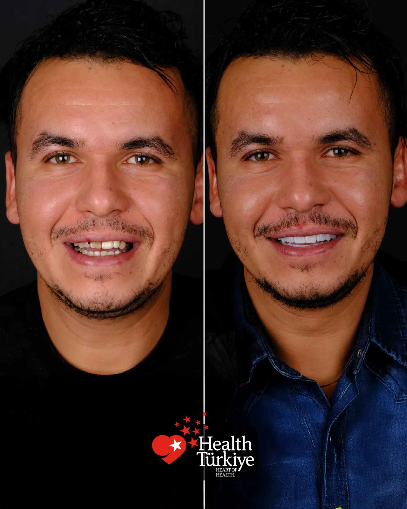 Klinik görseli