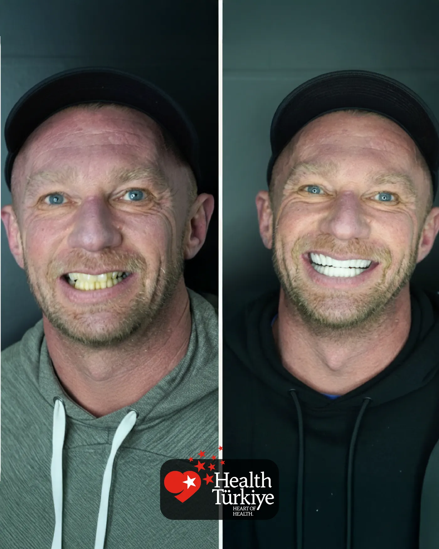 Klinik görseli